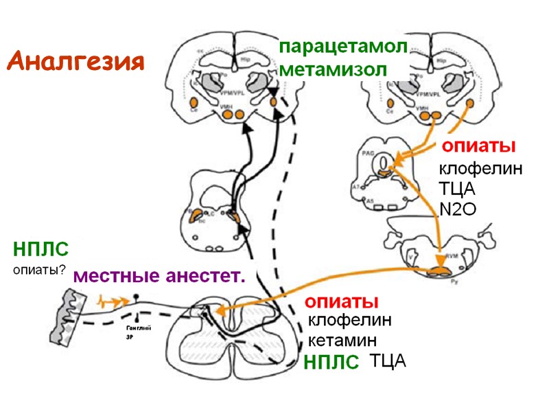 Аналгезия Аналгезия